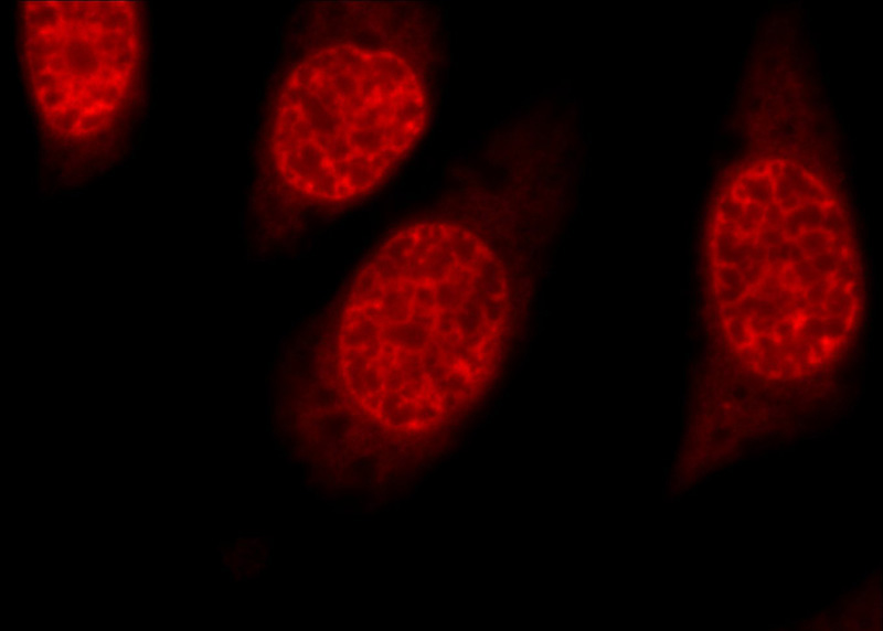 Immunofluorescent analysis of MCF-7 cells, using ELAVL1 antibody Catalog No:111725 at 1:50 dilution and Rhodamine-labeled goat anti-rabbit IgG (red).
