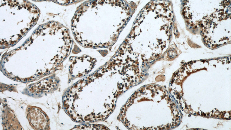 Immunohistochemical of paraffin-embedded human testis using Catalog No:109529(CPSF7 antibody) at dilution of 1:50 (under 10x lens)