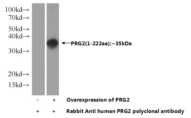 Transfected HEK-293 cells were subjected to SDS PAGE followed by western blot with Catalog No:114187(PRG2 Antibody) at dilution of 1:1000