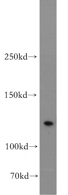 HeLa cells were subjected to SDS PAGE followed by western blot with Catalog No:110459(FAM111B antibody) at dilution of 1:500