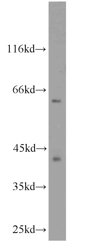 A431 cells were subjected to SDS PAGE followed by western blot with Catalog No:109168(CDK9 antibody) at dilution of 1:1000