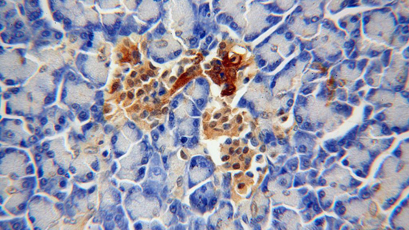 Immunohistochemical of paraffin-embedded human pancreas using Catalog No:117098(BCL2L13 antibody) at dilution of 1:100 (under 40x lens)