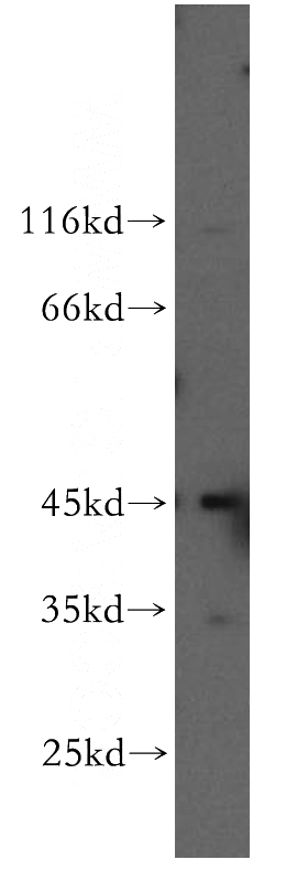 HeLa cells were subjected to SDS PAGE followed by western blot with Catalog No:109967(DNMT2 antibody) at dilution of 1:600
