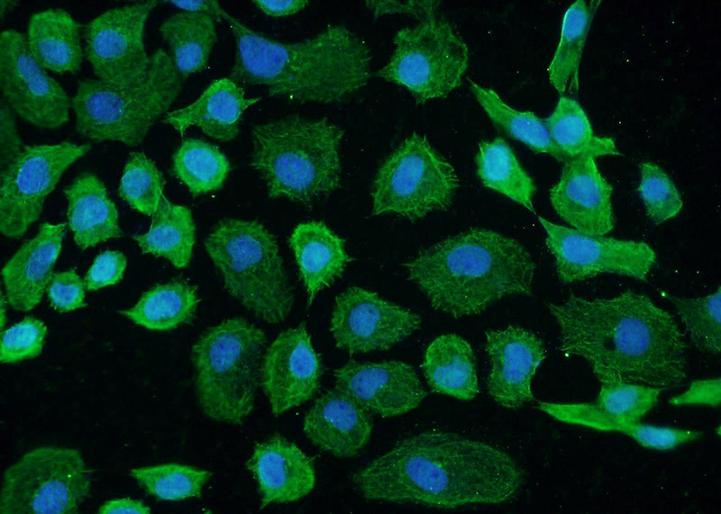 Immunofluorescent analysis of A431 cells using Catalog No:110899(GCC1 Antibody) at dilution of 1:25 and Alexa Fluor 488-congugated AffiniPure Goat Anti-Rabbit IgG(H+L)