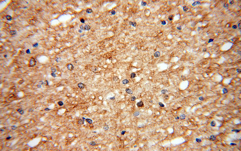 Immunohistochemical of paraffin-embedded human brain using Catalog No:116561(UGT8 antibody) at dilution of 1:100 (under 40x lens)