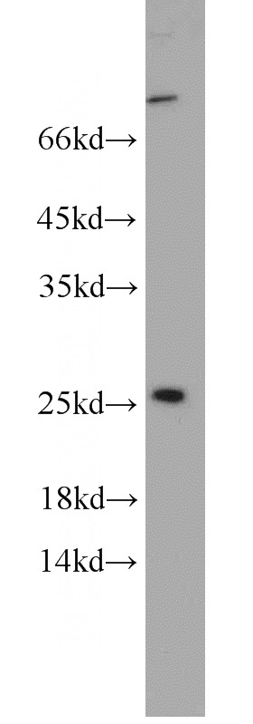 A431 cells were subjected to SDS PAGE followed by western blot with Catalog No:113495(PAIP2 antibody) at dilution of 1:500