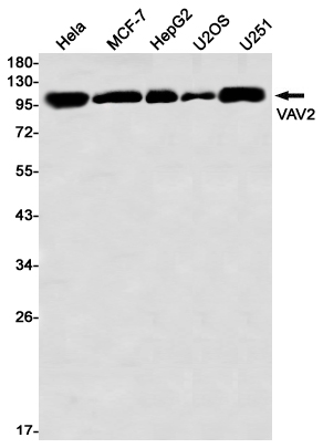 Western blot detection of VAV2 in Hela,MCF-7,HepG2,U2OS,U251 using VAV2 Rabbit mAb(1:1000 diluted)