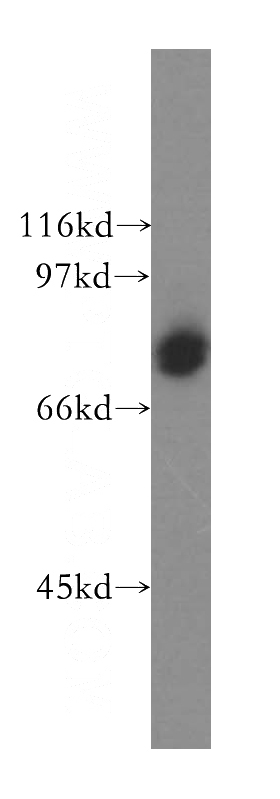 Jurkat cells were subjected to SDS PAGE followed by western blot with Catalog No:109143(CD86 antibody) at dilution of 1:500