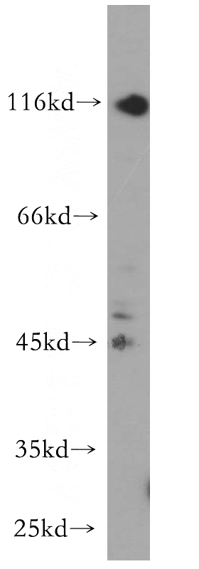 BxPC-3 cells were subjected to SDS PAGE followed by western blot with Catalog No:113543(P2RX5 antibody) at dilution of 1:600