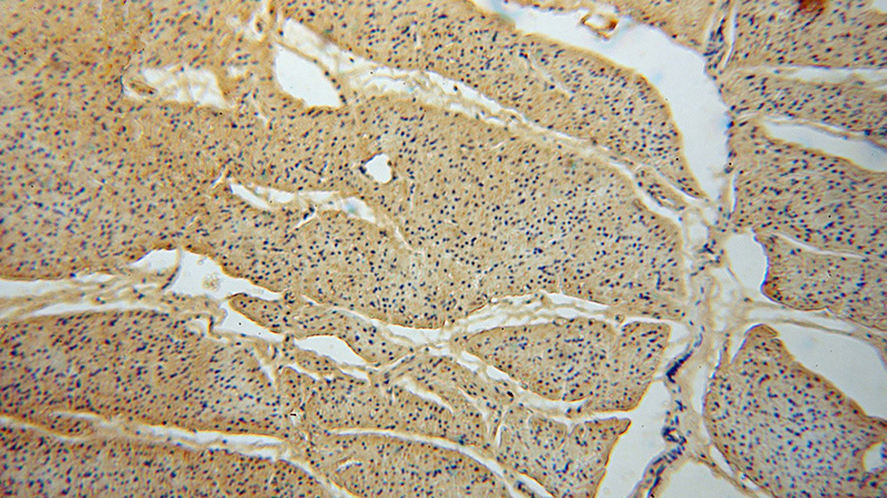 Immunohistochemical of paraffin-embedded human heart using Catalog No:115324(SLC25A15 antibody) at dilution of 1:50 (under 10x lens)