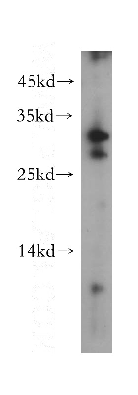 BxPC-3 cells were subjected to SDS PAGE followed by western blot with Catalog No:109346(CLEC10A antibody) at dilution of 1:400