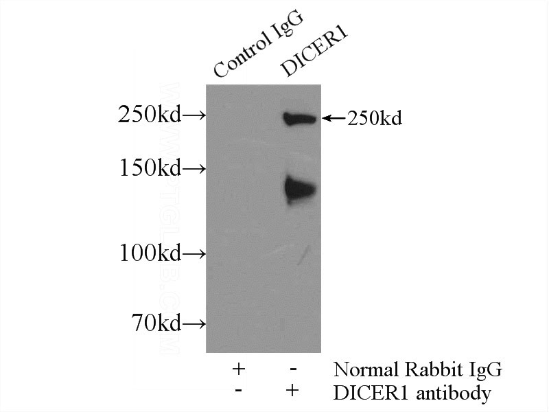 IP Result of anti-DICER1 (IP:Catalog No:109939, 5ug; Detection:Catalog No:109939 1:300) with Jurkat cells lysate 2000ug.