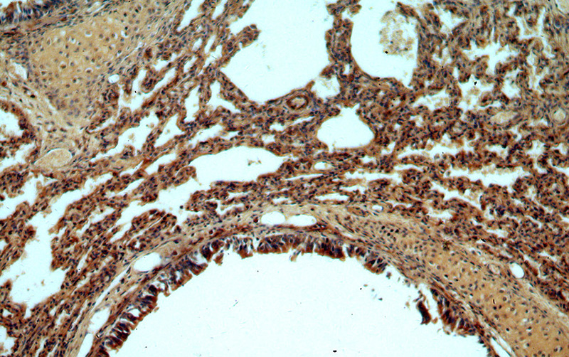Immunohistochemical of paraffin-embedded human lung using Catalog No:108639(C11orf51 antibody) at dilution of 1:50 (under 10x lens)