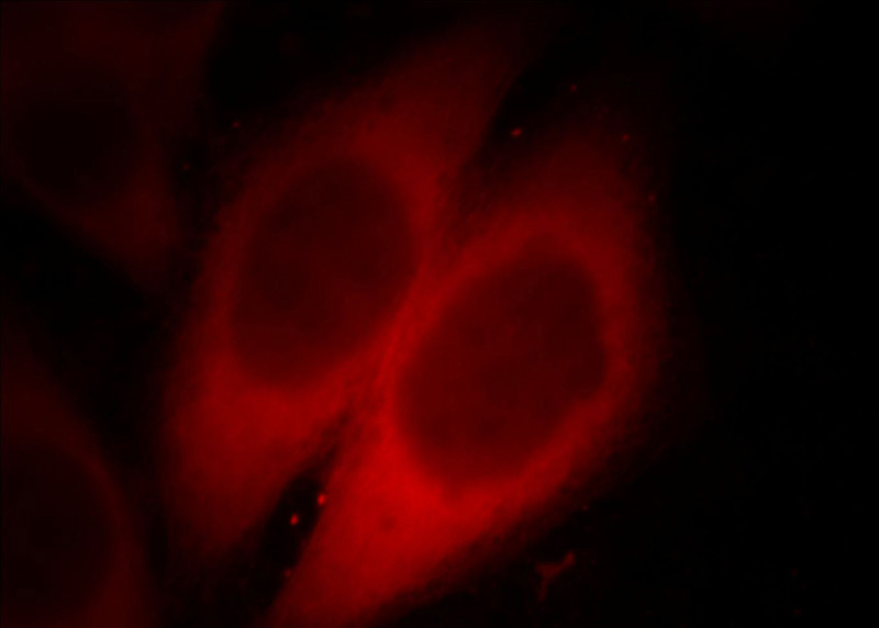 Immunofluorescent analysis of Hela cells, using RPS3 antibody Catalog No: at 1:25 dilution and Rhodamine-labeled goat anti-mouse IgG (red).