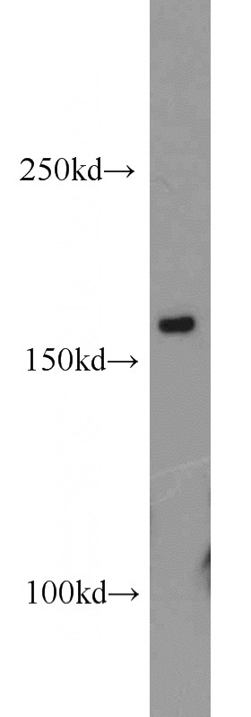 Jurkat cells were subjected to SDS PAGE followed by western blot with Catalog No:109524(CPSF1 antibody) at dilution of 1:500