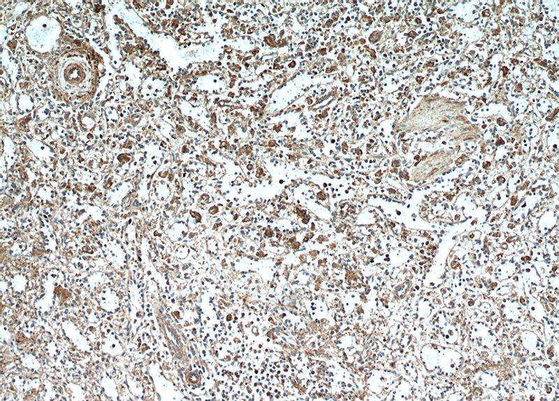 Immunohistochemical of paraffin-embedded human spleen using Catalog No:109041(CD11B antibody) at dilution of 1:50 (under 10x lens)