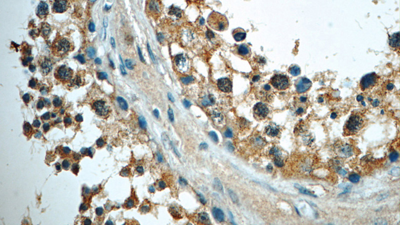 Immunohistochemistry of paraffin-embedded human testis tissue slide using Catalog No:112674(MLF1IP Antibody) at dilution of 1:50 (under 40x lens)