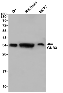 Western blot detection of GNB3 in C6,Rat Brain,MCF7 cell lysates using GNB3 Rabbit pAb(1:1000 diluted).Predicted band size:37KDa.Observed band size:37KDa.