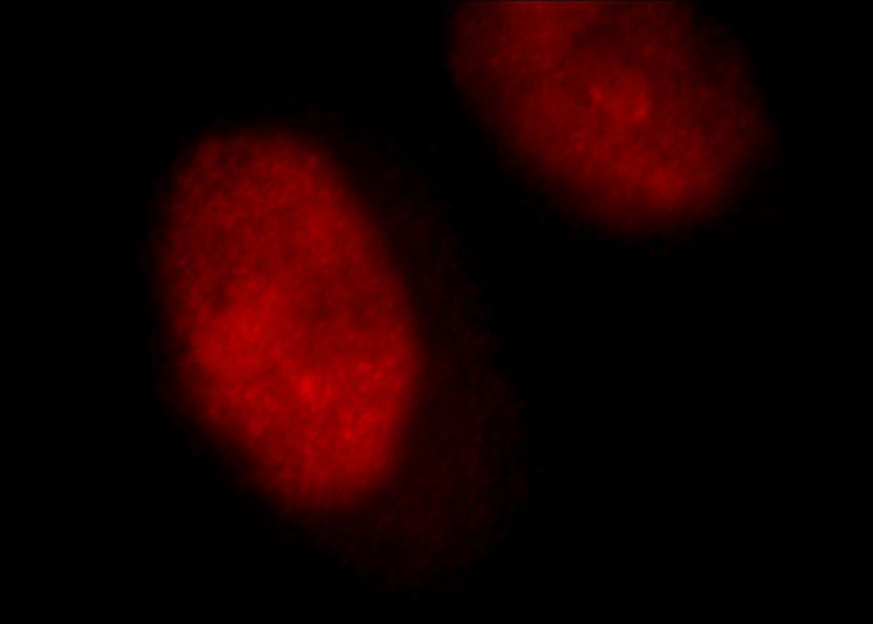 Immunofluorescent analysis of Hela cells, using ILF3 antibody Catalog No:111751 at 1:25 dilution and Rhodamine-labeled goat anti-rabbit IgG (red).