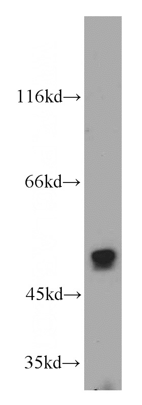 HeLa cells were subjected to SDS PAGE followed by western blot with Catalog No:113774(PFTK1 antibody) at dilution of 1:500