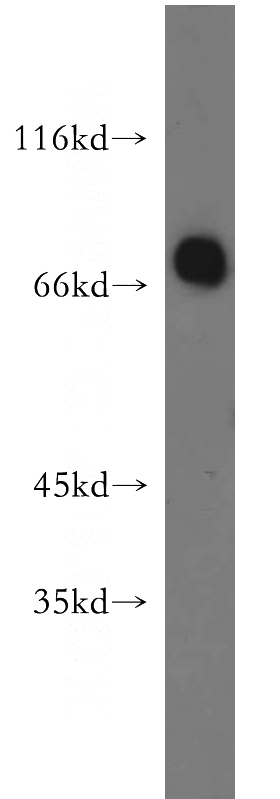 mouse lung tissue were subjected to SDS PAGE followed by western blot with Catalog No:116851(WBSCR17 antibody) at dilution of 1:500