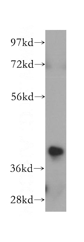 HeLa cells were subjected to SDS PAGE followed by western blot with Catalog No:113286(NSDHL antibody) at dilution of 1:500
