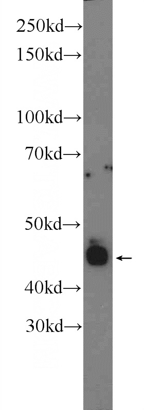 mouse eye tissue were subjected to SDS PAGE followed by western blot with Catalog No:115045(SAG Antibody) at dilution of 1:600