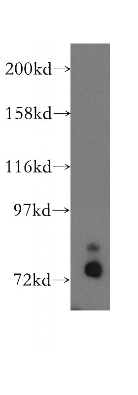 HeLa cells were subjected to SDS PAGE followed by western blot with Catalog No:109478(CTTN antibody) at dilution of 1:500