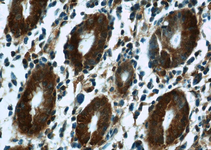 Immunohistochemistry of paraffin-embedded human stomach tissue slide using Catalog No:108936(CAPNS1 Antibody) at dilution of 1:50 (under 40x lens)