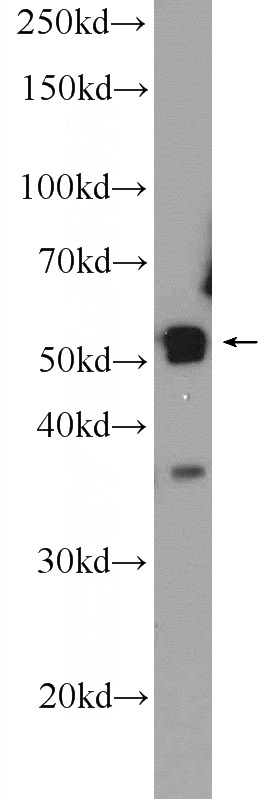HeLa cells were subjected to SDS PAGE followed by western blot with Catalog No:113965(PLEKHO2 Antibody) at dilution of 1:300