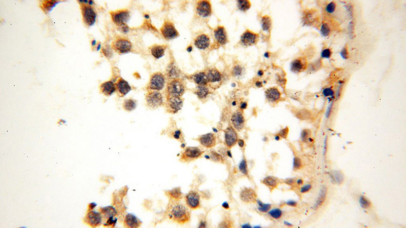Immunohistochemical of paraffin-embedded human testis using Catalog No:109761(DCTN6 antibody) at dilution of 1:100 (under 40x lens)