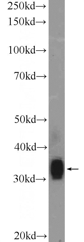 mouse liver tissue were subjected to SDS PAGE followed by western blot with Catalog No:110689(FLJ25006 Antibody) at dilution of 1:600