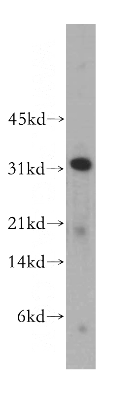 mouse lung tissue were subjected to SDS PAGE followed by western blot with Catalog No:109351(CLEC1A antibody) at dilution of 1:300