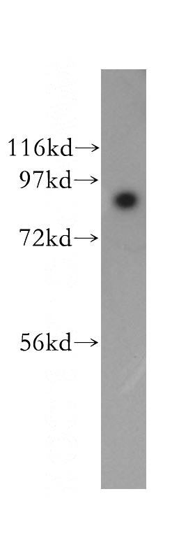 A431 cells were subjected to SDS PAGE followed by western blot with Catalog No:115090(SEC63 antibody) at dilution of 1:1000