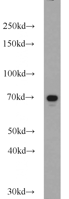 A549 cells were subjected to SDS PAGE followed by western blot with Catalog No:115034(SDPR antibody) at dilution of 1:1000