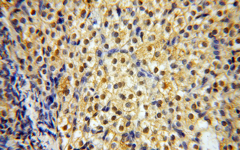 Immunohistochemical of paraffin-embedded human ovary using Catalog No:109420(CNBP antibody) at dilution of 1:50 (under 40x lens)