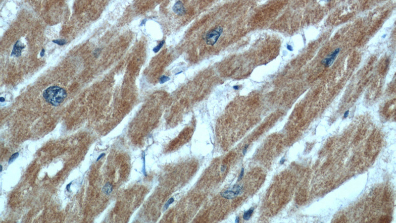 Immunohistochemical of paraffin-embedded human heart using Catalog No:108056(ANGPTL2 antibody) at dilution of 1:50 (under 40x lens)