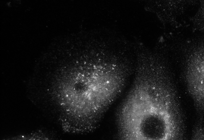 IF result (endosomal stain) of anti-CHMP2B (Catalog No:109234) with the cell (PFA fixed) which has been treated with siRNA for VPS4 by Dr. Philip Woodman.