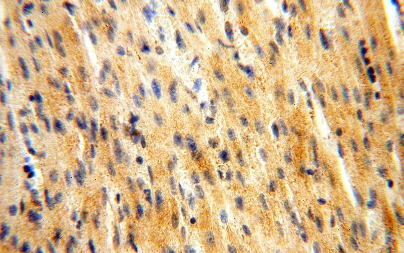 Immunohistochemical of paraffin-embedded human heart using Catalog No:109401(CLPP antibody) at dilution of 1:50 (under 40x lens)