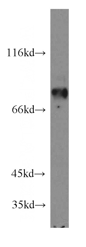 NIH/3T3 cells were subjected to SDS PAGE followed by western blot with Catalog No:110612(APBB1 antibody) at dilution of 1:300