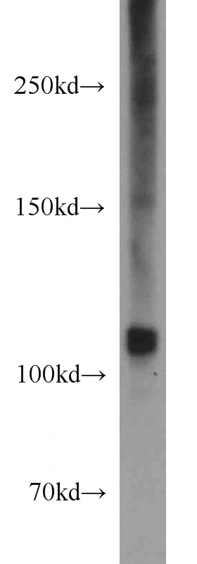 Jurkat cells were subjected to SDS PAGE followed by western blot with Catalog No:114364(PTK2B antibody) at dilution of 1:1500