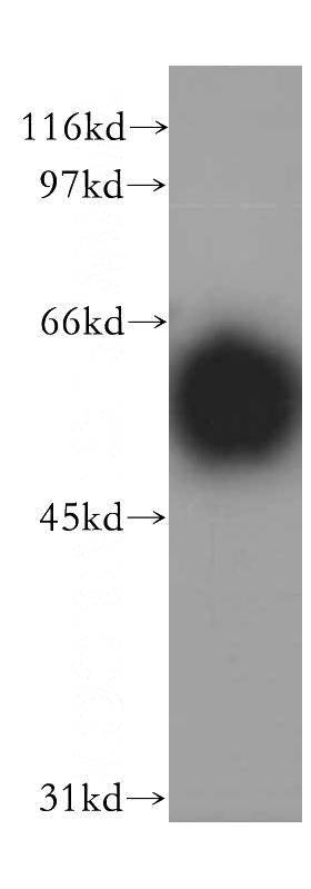 human adrenal gland tissue were subjected to SDS PAGE followed by western blot with Catalog No:111816(IP6K2 antibody) at dilution of 1:500