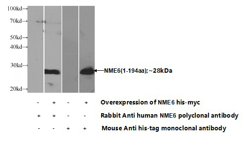 Transfected HEK-293 cells were subjected to SDS PAGE followed by western blot with Catalog No:113250(NME6 Antibody) at dilution of 1:1000