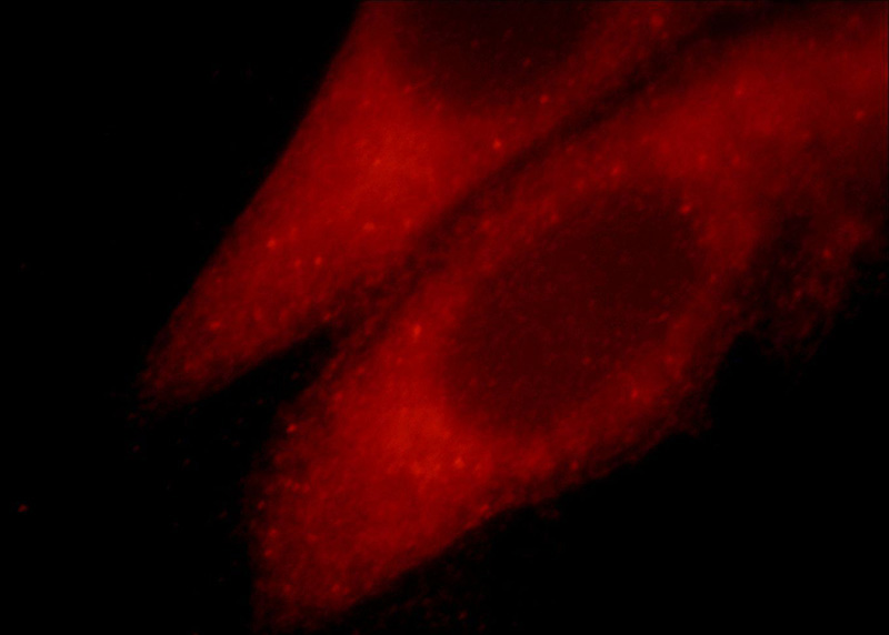 Immunofluorescent analysis of HepG2 cells, using TRIM54 antibody Catalog No:116320 at 1:25 dilution and Rhodamine-labeled goat anti-rabbit IgG (red).