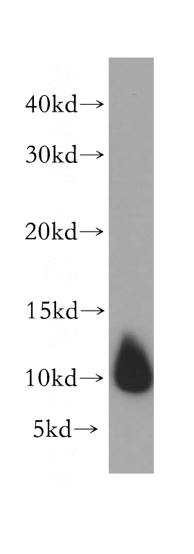 human heart tissue were subjected to SDS PAGE followed by western blot with Catalog No:110140(DYNLL2 antibody) at dilution of 1:400