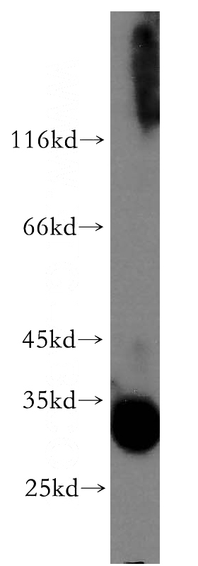 A549 cells were subjected to SDS PAGE followed by western blot with Catalog No:116226(TRA2A antibody) at dilution of 1:3000