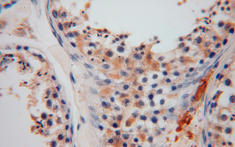 Immunohistochemical of paraffin-embedded human testis using Catalog No:111186(GSTM3 antibody) at dilution of 1:100 (under 40x lens)