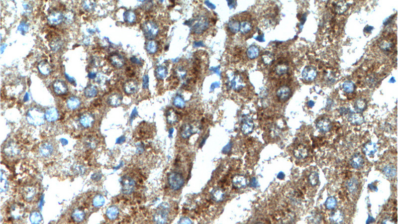 Immunohistochemistry of paraffin-embedded human liver tissue slide using Catalog No:114989(SCD Antibody) at dilution of 1:200 (under 40x lens).