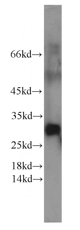 HepG2 cells were subjected to SDS PAGE followed by western blot with Catalog No:114061(POP4 antibody) at dilution of 1:500
