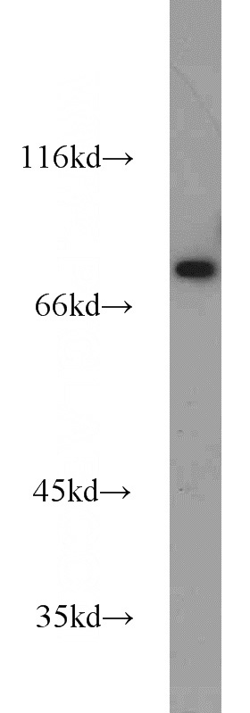 HepG2 cells were subjected to SDS PAGE followed by western blot with Catalog No:116961(ZNF23 antibody) at dilution of 1:1000